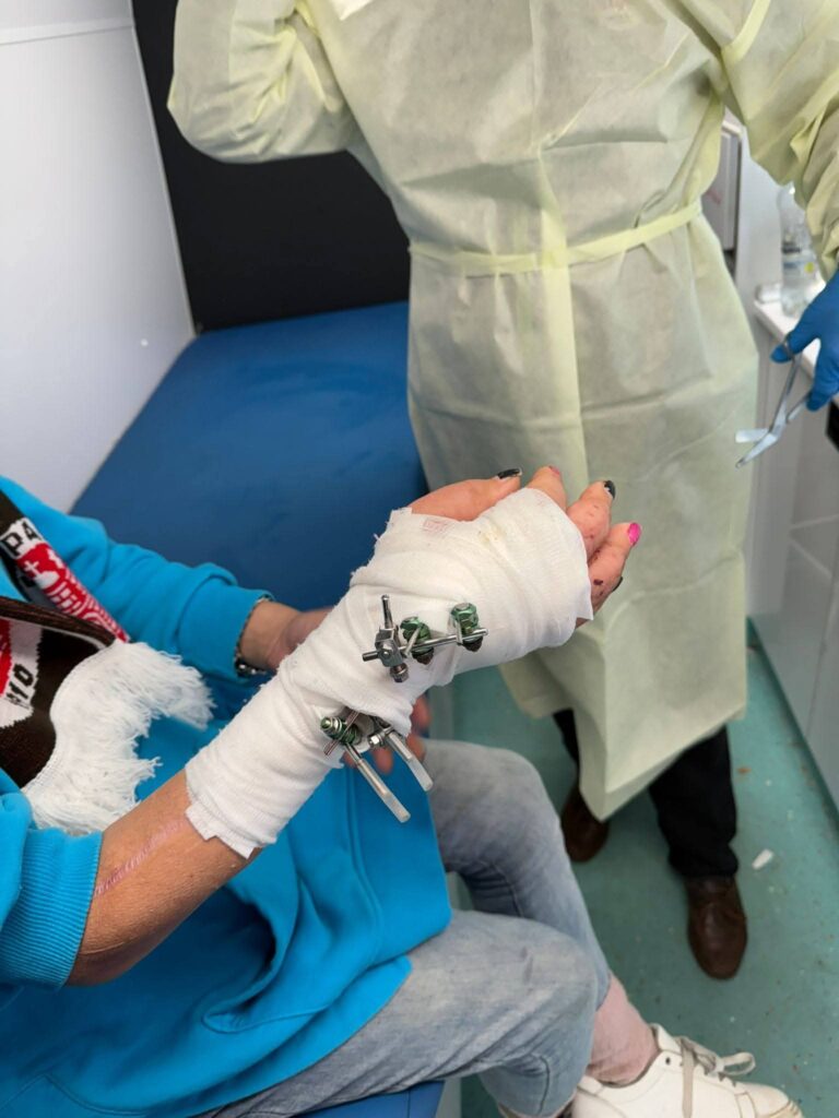 Ein geschienter Bruch wird im Gesundheitsmobil neu verbunden.